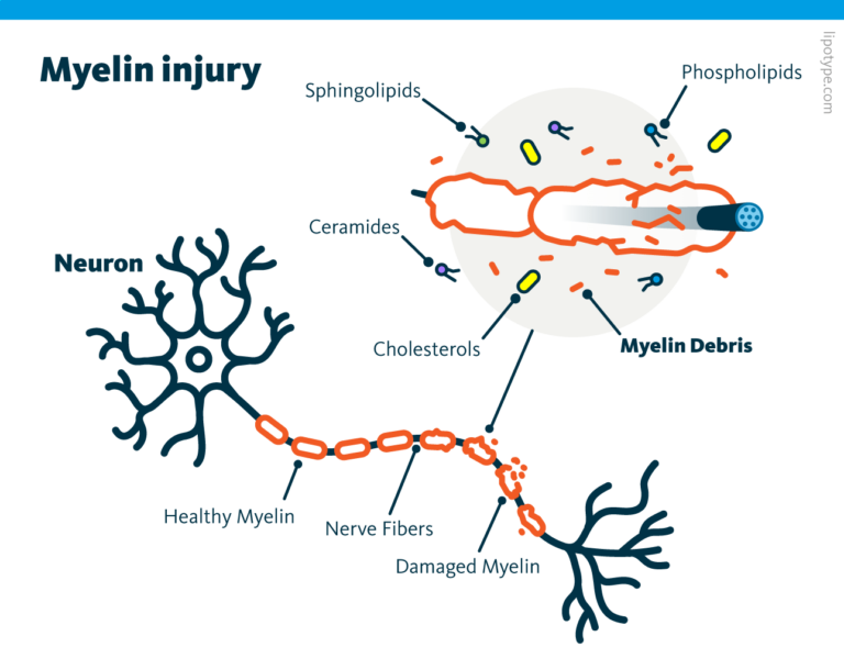 Endoplasmic Reticulum Stress Lipid Metabolism Lipotype Gmbh