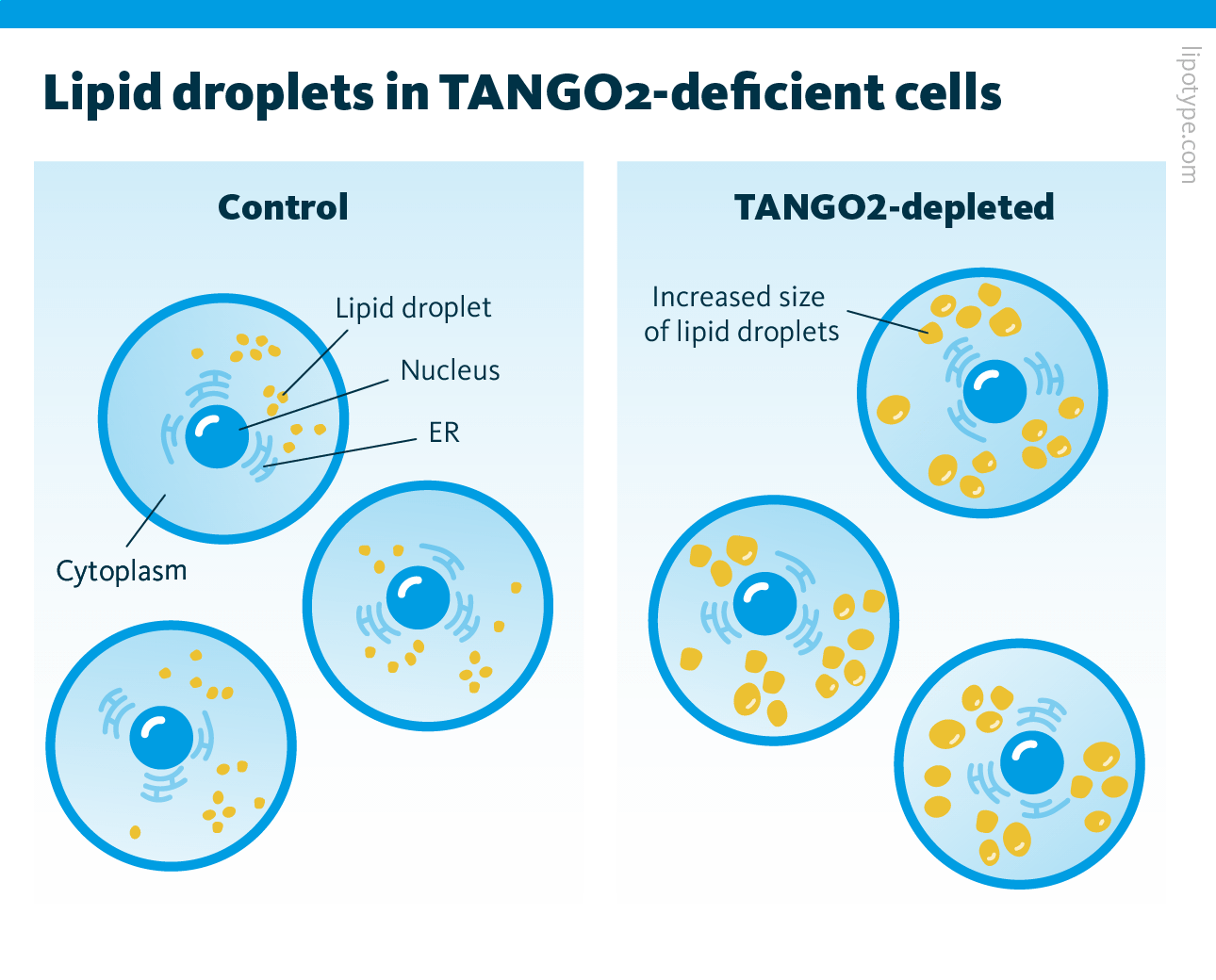 TANGO2-lacking cells contain larger LDs. Schematic representation of liver cancer cells with normal TANGO2 (left image) and silenced TANGO2 (right image). TANGO2-depleted cells have more lipid droplets compared to control cells.